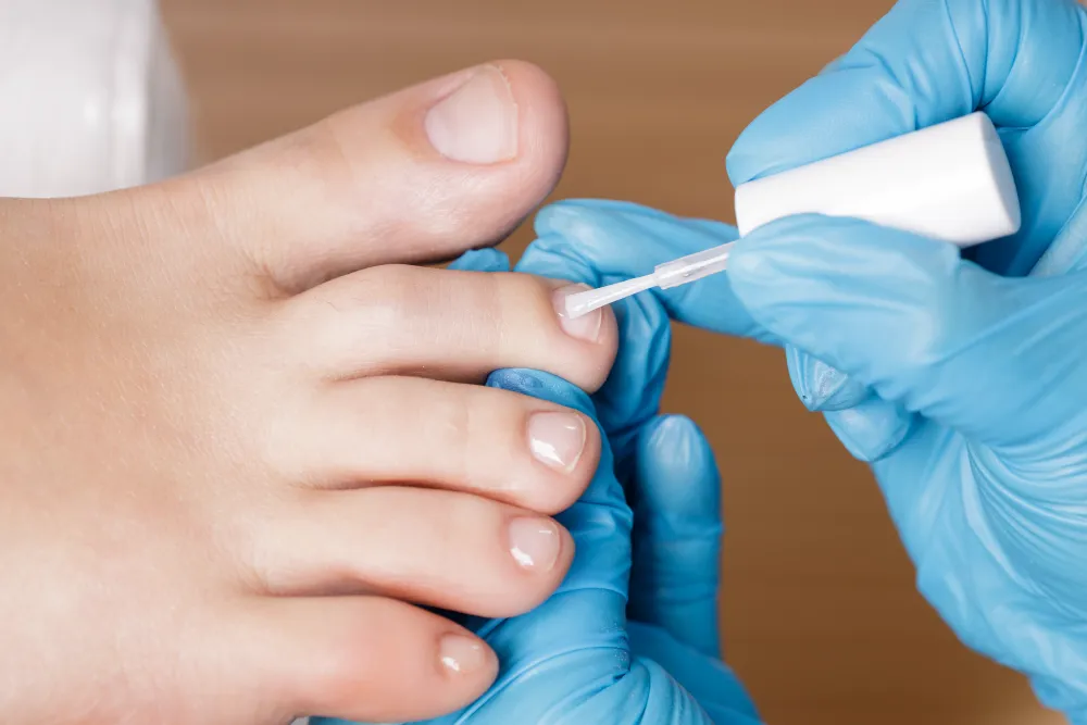Hand im Handschuh trägt farblosen Lack auf einen Zehennagel auf